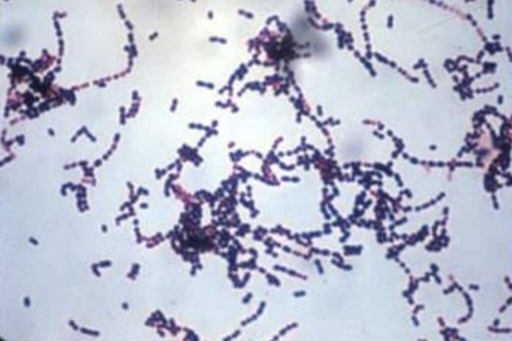 Evaluation and improvement of Streptococcus suis bacterins in sows