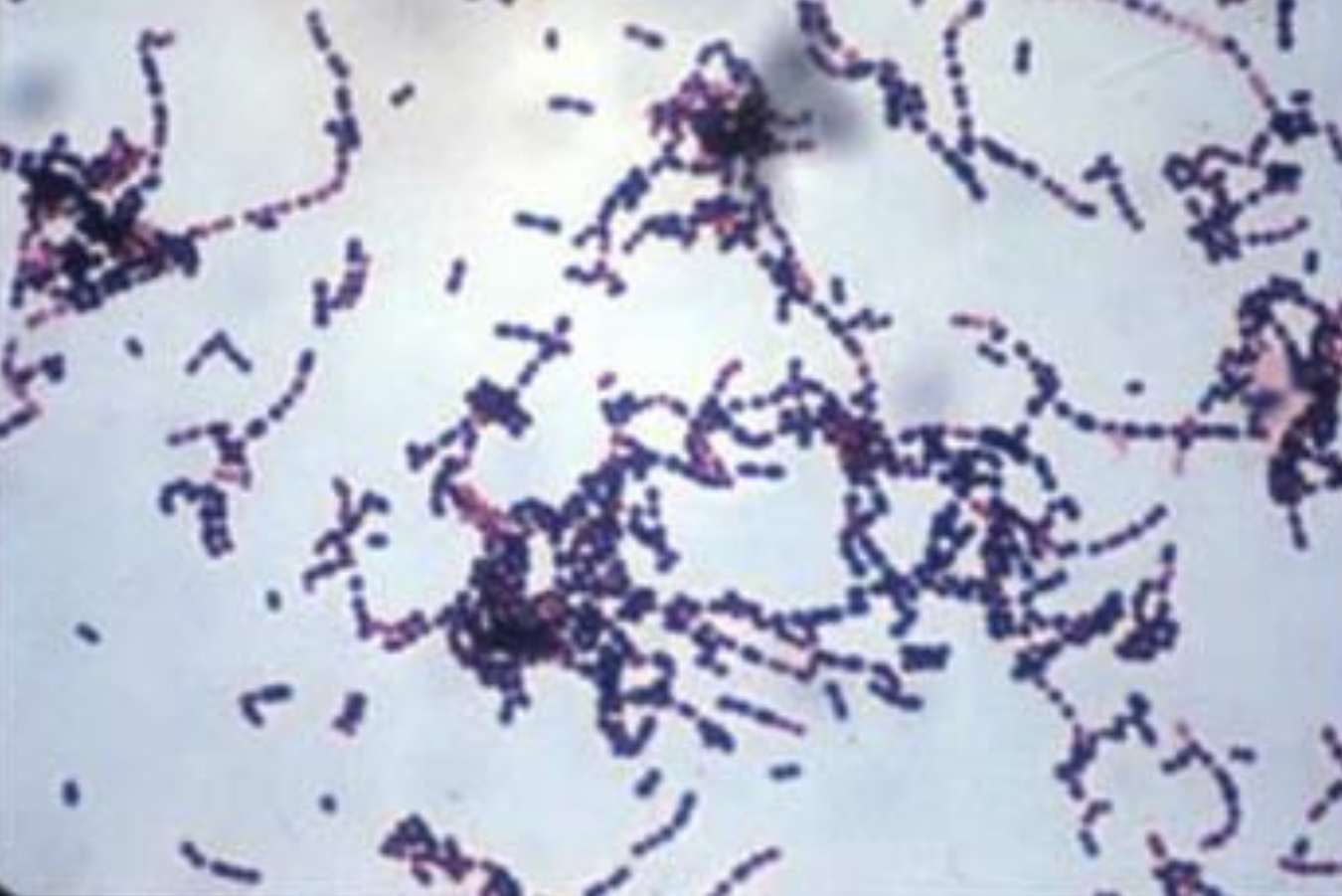 Evaluation and improvement of Streptococcus suis bacterins in sows